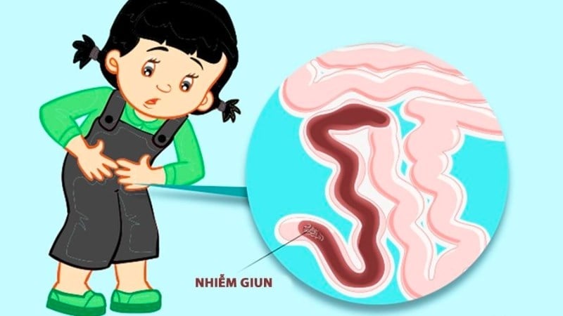 Tẩy giun định kỳ cho bé – Nhiều cha mẹ đang làm sai cách! Nhiều cha mẹ mắc sai lầm khi chỉ tẩy giun cho trẻ khi có biểu hiện